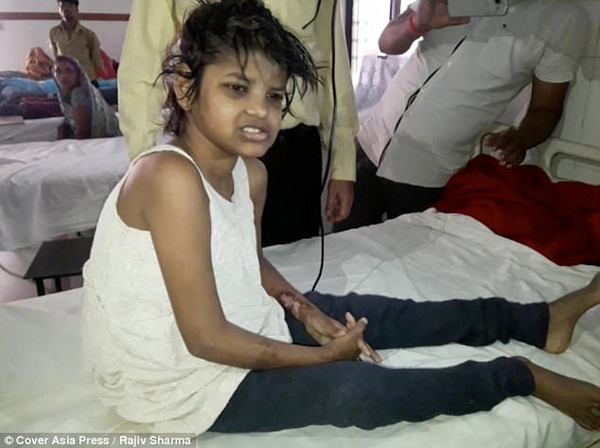 驚愕 サルに８年間育てられた少女がインドで発見されたと話題に