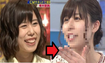 有村藍里　整形
